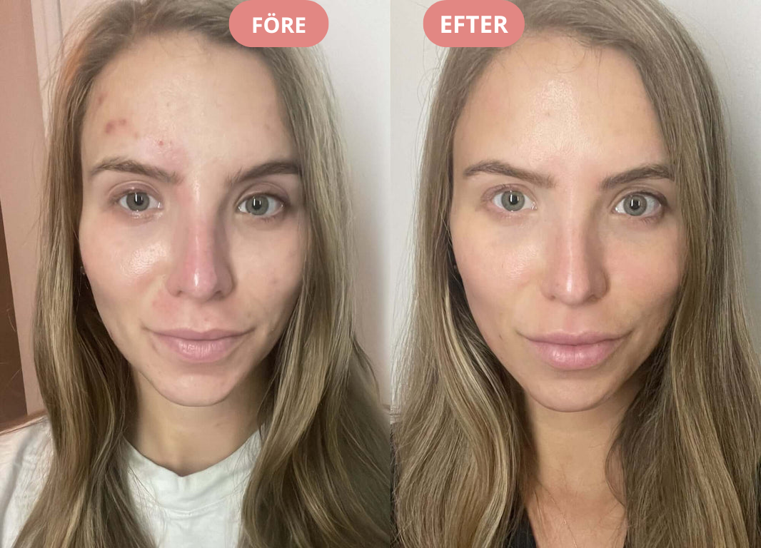 Celivra- Salongseffekt medan du sover